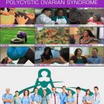 PCOS - Polycystic Ovary Syndrome